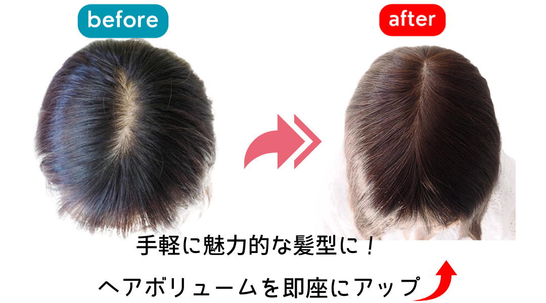 ヘアピース（人毛） - 医療用ウィッグ通販の専門店【あっちパパ】